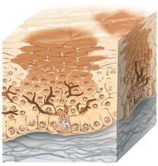 Quá trình melanin được sản sinh quá mức dẫn đến tăng sắc tố da.