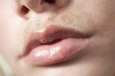 Cận cảnh môi trên khi tăng sắc tố da