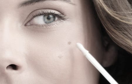 Hình ảnh người phụ nữ đang sử dụng sản phẩm hiệu chỉnh các nốt trên da