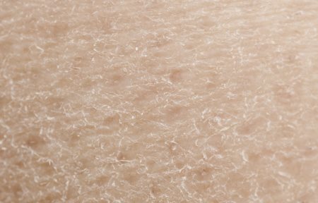 Nhìn cận cảnh làn da khô 